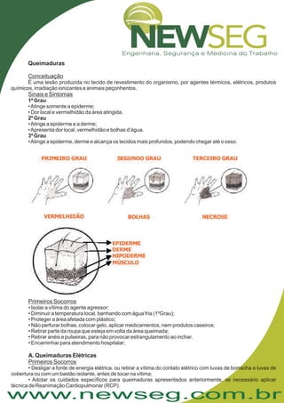 www.newseg.com.br
Queimaduras
Conceituação
Sinais e Sintomas
É uma lesão produzida no tecido de revestimento do organismo, por agentes térmicos, elétricos, produtos
químicos, irradiação ionizantes e animais peçonhentos.
•Atinge somente a epiderme;
• Dor local e vermelhidão da área atingida.
•Atinge a epiderme e a derme;
•Apresenta dor local, vermelhidão e bolhas d’água.
•Atinge a epiderme, derme e alcança os tecidos mais profundos, podendo chegar até o osso.
1º Grau
2º Grau
3º Grau
Primeiros Socorros
Primeiros Socorros
• Isolar a vítima do agente agressor;
• Diminuir a temperatura local, banhando com água fria (1ºGrau);
• Proteger a área afetada com plástico;
• Não perfurar bolhas, colocar gelo, aplicar medicamentos, nem produtos caseiros;
• Retirar parte da roupa que esteja em volta da área queimada;
• Retirar anéis e pulseiras, para não provocar estrangulamento ao inchar.
• Encaminhar para atendimento hospitalar;
• Desligar a fonte de energia elétrica, ou retirar a vítima do contato elétrico com luvas de borracha e luvas de
cobertura ou com um bastão isolante, antes de tocar na vítima;
• Adotar os cuidados específicos para queimaduras apresentados anteriormente, se necessário aplicar
técnica de Reanimação Cardiopulmonar (RCP).
A. Queimaduras Elétricas
 