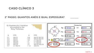 CASO CLÍNICO 3
2° PASSO: QUANTOS ANÉIS E QUAL ESPESSURA? .................
R:
1
seg
160°/20
 