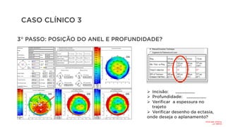CASO CLÍNICO 3
3° PASSO: POSIÇÃO DO ANEL E PROFUNDIDADE?
Ø  Incisão:
Ø  Profundidade:
Ø  Verificar a espessura no
trajeto
Ø  Verificar desenho da ectasia,
onde deseja o aplanamento?
.................
.................
Incisão:
41°
Profund:
465
micra
 