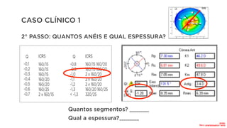 CASO CLÍNICO 1
2° PASSO: QUANTOS ANÉIS E QUAL ESPESSURA?
Quantos segmentos?
Qual a espessura?
.................
.................
QUAL
A
ESPESSURA?
2
seg
160/20
 