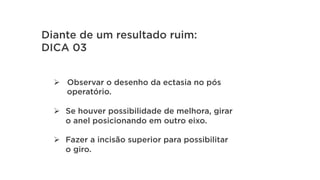 Ø  Observar o desenho da ectasia no pós
operatório.
Ø  Se houver possibilidade de melhora, girar
o anel posicionando em outro eixo.
Ø  Fazer a incisão superior para possibilitar
o giro.
Diante de um resultado ruim:
DICA 03
 