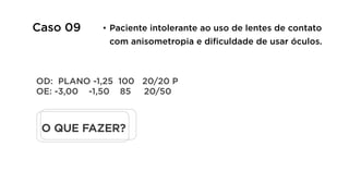 O QUE FAZER?
OD: PLANO -1,25 100 20/20 P
OE: -3,00 -1,50 85 20/50
Caso 09 •  Paciente intolerante ao uso de lentes de contato
com anisometropia e dificuldade de usar óculos.
 