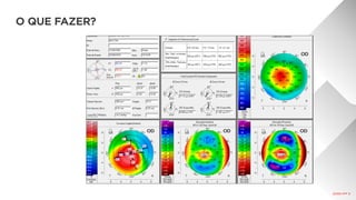 O QUE FAZER?
R:	anel	320/25	
 