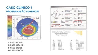 CASO CLÍNICO 1
PROGRAMAÇÃO SUGERIDA?
1- 2 SEG 160/20
2- 1 SEG 160/ 25
3- 1 SEG 210/25
4- 1 SEG 320/20
 