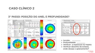 CASO CLÍNICO 2
3° PASSO: POSIÇÃO DO ANEL E PROFUNDIDADE?
Ø  Incisão:
Ø  Profundidade:
Ø  Verificar a espessura no trajeto
Ø  Verificar desenho da ectasia,
onde deseja o aplanamento?
.................
.................
Incisão:
41°
Prof:
465
micra
 