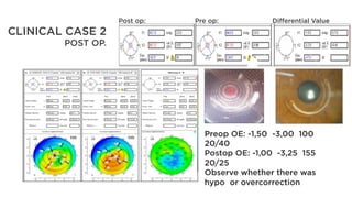Hypho Post apostila-refrativa-rio-ingles-final-pdf-revisado.pdf
