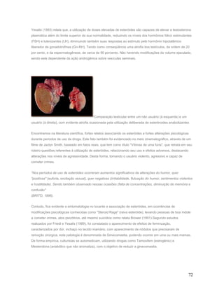 Yesalis (1993) relata que, a utilização de doses elevadas de esteróides são capazes de elevar a testosterona
plasmática além do limite superior da sua normalidade, reduzindo os níveis dos hormônios fólico estimulantes
(FSH) e lutenizantes (LH), diminuindo também suas respostas ao estímulo pelo hormônio hipotalâmico
liberador de gonadotrofinas (Gn-RH). Tendo como conseqüência uma atrofia dos testículos, da ordem de 20
por cento, e da espermatogênese, de cerca de 90 porcento. Não havendo modificações do volume ejaculado,
sendo este dependente da ação androgênica sobre vesículas seminais.




                                            Comparação testicular entre um não usuário (à esquerda) e um
usuário (à direita), com evidente atrofia ocasionada pela utilização deliberada de esteréroides anabolizantes


Encontramos na literatura científica, fortes relatos associando os esteróides a fortes alterações psicológicas
durante períodos de uso da droga. Este fato também foi evidenciado no meio cinematográfico, através de um
filme de Jaclyn Smith, baseado em fatos reais, que tem como título "Vítimas de uma fúria", que retrata em seu
roteiro questões referentes à utilização de esteróides, relacionando seu uso e efeitos adversos, destacando
alterações nos níveis de agressividade. Desta forma, tornando o usuário violento, agressivo e capaz de
cometer crimes.


"Nos períodos de uso de esteróides ocorreram aumentos significativos de alterações do humor, quer
"positivas" (euforia, excitação sexual), quer negativas (irritabilidade, flutuação do humor, sentimentos violentos
e hostilidade). Sendo também observado nessas ocasiões (falta de concentrações, diminuição de memória e
confusão"
(BRITO, 1996).


Contudo, fica evidente a sintomatologia no tocante a associação de esteróides, em ocorrências de
modificações psicológicas conhecidas como ''Steroid Rage" (raiva esteróide), levando pessoas de boa índole
a cometer crimes, atos psicóticos, até mesmo suicídios como relata Brower (1991).Segundo estudos
realizados por Friedl e Yesalis (1989), foi constatado o aparecimento de efeitos de feminização,
caracterizados por dor, inchaço no tecido mamário, com aparecimento de nódulos que precisaram de
remoção cirúrgica, esta patologia é denominada de Ginecomastia, podendo ocorrer em uma ou mais mamas.
De forma empírica, culturistas se automedicam, utilizando drogas como Tamoxifem (estrogênio) e
Mesterolona (anabólico que não aromatiza), com o objetivo de reduzir a ginecomastia.




                                                                                                               72
 