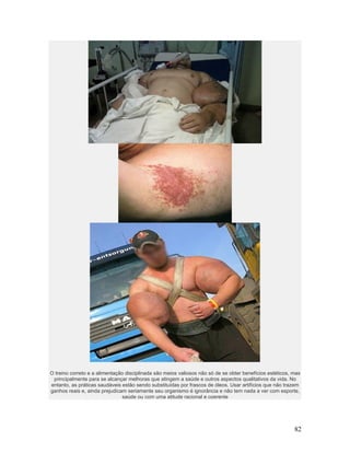 O treino correto e a alimentação disciplinada são meios valiosos não só de se obter benefícios estéticos, mas
 principalmente para se alcançar melhoras que atingem a saúde e outros aspectos qualitativos da vida. No
entanto, as práticas saudáveis estão sendo substituídas por frascos de óleos. Usar artifícios que não trazem
ganhos reais e, ainda prejudicam seriamente seu organismo é ignorância e não tem nada a ver com esporte,
                               saúde ou com uma atitude racional e coerente




                                                                                                          82
 