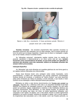 80
Grandes circulares - Os circulares propriamente ditos (grandes circulares ou
aflorações psíquicas) são realizados com as mãos paradas, mas os braços girando em
torno do ponto que se deseja magnetizar. Imagine que irá alisar ou massagear a região
que vai ser tratada, sempre no sentido horário.
As "aflorações psíquicas", abrangendo regiões maiores (mas na medida do
possível, atendendo e relacionando-se a um único centro vital por vez), também
funcionam como concentradoras de fluidos, só que tanto podem ser aplicadas na
estrutura dos ativantes como dos calmantes; todavia os resultados ativantes são
sempre melhor pronunciados.
Indicação Específica
As "aflorações" são muito eficientes em questões gástricas de uma forma geral ou
em regiões maiores inflamadas e/ou infeccionadas.
Essas duas técnicas levam uma vantagem sobre certas imposições, como
concentradoras: a prática tem demonstrado que quando realizamos concentrações
fluídicas através de circulares, a incidência de "retorno fluídico", que seria absorvido
pelos polos emissores (as mãos) do passista, é muito reduzida, o que resulta e maior
conforto na sua realização e melhor absorção fluídica pelo paciente.
Michaelus se refere a esta técnica denominando-a de “fricções sem contato” ou
“afloração”. Segundo ele, a diferença entre esta e os pequenos circulares é que aqui
fazemos uma espécie de massagem psíquica e não apenas rotações. Por isso estas
podem ser palmares, digitais, longitudinais e rotatórios, e têm finalidades idênticas aos
circulares propriamente. Para Michaelus, no caso dessas fricções, as palmares são
feitas com as palmas das mãos, em cheio, os dedos ligeiramente afastados, sem
crispações e sem rigidez. As digitais, com a mão aberta, ficando os dedos ligeiramente
afastados e um pouco curvados, evitando-se contração e rigidez, com o punho erguido.
As longitudinais são executadas com a mão aberta, como nas fricções palmares, ou
Fig. 44b – Pequeno circular – posição da mão e sentido de aplicação
Apenas a mão faz o movimento. O braço permanece parado. Retorna à
posição inicial com a mão fechada.
 