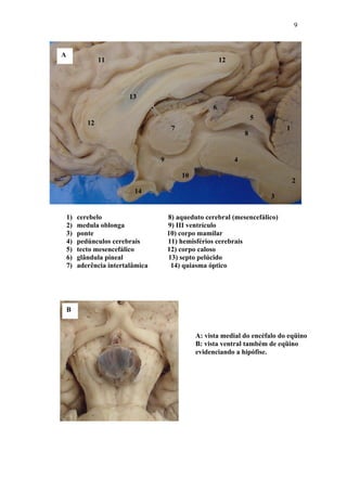 9



A
                 11                                       12




                          13
                                                      6
                                                                       5
            12
                                        7                                      1
                                                                   8


                                   9                           4

                                            10
                                                                                   2
                           14
                                                                           3

    1)   cerebelo                      8) aqueduto cerebral (mesencefálico)
    2)   medula oblonga                9) III ventrículo
    3)   ponte                         10) corpo mamilar
    4)   pedúnculos cerebrais          11) hemisférios cerebrais
    5)   tecto mesencefálico           12) corpo caloso
    6)   glândula pineal               13) septo pelúcido
    7)   aderência intertalâmica        14) quiasma óptico




    B


                                                 A: vista medial do encéfalo do eqüino
                                                 B: vista ventral também de eqüino
                                                 evidenciando a hipófise.
 