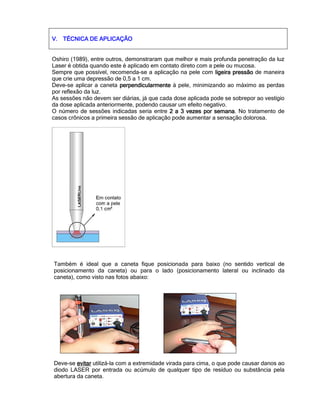 V.V.V.V. TÉCNICA DE APLICAÇÃOTÉCNICA DE APLICAÇÃOTÉCNICA DE APLICAÇÃOTÉCNICA DE APLICAÇÃO
Oshiro (1989), entre outros, demonstraram que melhor e mais profunda penetração da luz
Laser é obtida quando este é aplicado em contato direto com a pele ou mucosa.
Sempre que possível, recomenda-se a aplicação na pele com ligeira pressãoligeira pressãoligeira pressãoligeira pressão de maneira
que crie uma depressão de 0,5 a 1 cm.
Deve-se aplicar a caneta perpendicularmeperpendicularmeperpendicularmeperpendicularmennnntetetete à pele, minimizando ao máximo as perdas
por reflexão da luz.
As sessões não devem ser diárias, já que cada dose aplicada pode se sobrepor ao vestígio
da dose aplicada anteriormente, podendo causar um efeito negativo.
O número de sessões indicadas seria entre 2 a 3 vezes por semana2 a 3 vezes por semana2 a 3 vezes por semana2 a 3 vezes por semana. No tratamento de
casos crônicos a primeira sessão de aplicação pode aumentar a sensação dolorosa.
Também é ideal que a caneta fique posicionada para baixo (no sentido vertical de
posicionamento da caneta) ou para o lado (posicionamento lateral ou inclinado da
caneta), como visto nas fotos abaixo:
Deve-se evitarevitarevitarevitar utilizá-la com a extremidade virada para cima, o que pode causar danos ao
diodo LASER por entrada ou acúmulo de qualquer tipo de resíduo ou substância pela
abertura da caneta.
 