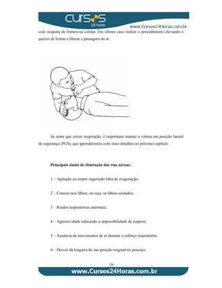 com suspeita de fratura na coluna. Em último caso realize o procedimento elevando o 
queixo de forma a liberar a passagem do ar. 
Se notar que existe respiração, é importante manter a vítima em posição lateral 
de segurança (PLS), que aprenderemos com mais detalhes no próximo capítulo. 
Principais sinais de obstrução das vias aéreas: 
1 – Agitação ou torpor sugerindo falta de oxigenação; 
2 – Cianose nos lábios, ou seja, os lábios azulados; 
19 
3 – Ruídos respiratórios anormais; 
4 – Agressividade indicando a impossibilidade de respirar; 
5 – Ausência de movimentos de ar durante o esforço respiratório; 
6 – Desvio da traqueia de sua posição original no pescoço. 
 