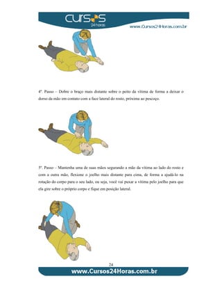 4º. Passo – Dobre o braço mais distante sobre o peito da vítima de forma a deixar o 
dorso da mão em contato com a face lateral do rosto, próxima ao pescoço. 
5º. Passo – Mantenha uma de suas mãos segurando a mão da vítima ao lado do rosto e 
com a outra mão, flexione o joelho mais distante para cima, de forma a ajudá-lo na 
rotação do corpo para o seu lado, ou seja, você vai puxar a vítima pelo joelho para que 
ela gire sobre o próprio corpo e fique em posição lateral. 
24 
 