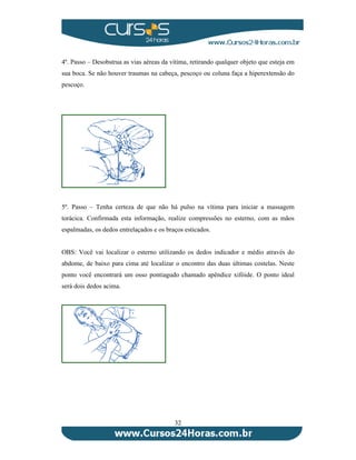 4º. Passo – Desobstrua as vias aéreas da vítima, retirando qualquer objeto que esteja em 
sua boca. Se não houver traumas na cabeça, pescoço ou coluna faça a hiperextensão do 
pescoço. 
5º. Passo – Tenha certeza de que não há pulso na vítima para iniciar a massagem 
torácica. Confirmada esta informação, realize compressões no esterno, com as mãos 
espalmadas, os dedos entrelaçados e os braços esticados. 
OBS: Você vai localizar o esterno utilizando os dedos indicador e médio através do 
abdome, de baixo para cima até localizar o encontro das duas últimas costelas. Neste 
ponto você encontrará um osso pontiagudo chamado apêndice xifóide. O ponto ideal 
será dois dedos acima. 
32 
 