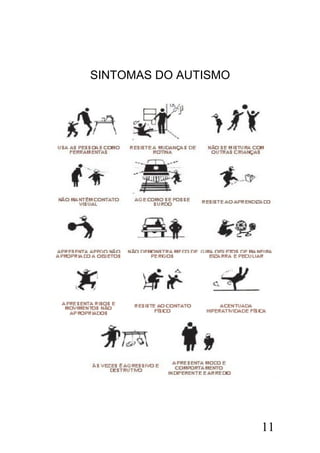 SINTOMAS DO AUTISMO
11
 