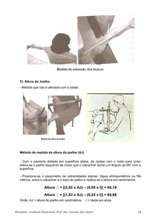 Disciplina: Avaliação Nutricional. Prof. Msc. Luciano Alex Santos 34
C) Altura do Joelho
- Medida que não é alterada com a idade
Método de medida da altura do joelho (AJ)
- Com o paciente deitado em superfície plana, de costas com o rosto para cima,
dobra-se o joelho esquerdo de modo que o calcanhar forme um ângulo de 90º com a
superfície.
- Posiciona-se o paquímetro de extremidades planas, régua antropométrica ou fita
métrica, entre o calcanhar e o topo do joelho e realiza-se a leitura em centímetros.
Altura ♂ = [(2,02 x AJ) – (0,04 x I)] + 64,19
Altura ♀ = [(1,83 x AJ) – (0,24 x I)] + 84,88
Onde: AJ = altura do joelho em centímetros. I = idade em anos.
 