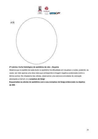 25
4ª Lâmina: Corte histológico de epidídimo de rato – Aoyama
Observe que no epitélio de cada ducto no epidídimo há dificuldade em visualizar o núcleo, podendo, às
vezes, ser visto apenas uma área clara que corresponde à imagem negativa evidenciada (como a
lâmina acima). No citoplasma das células, observamos uma estrutura enovelada de coloração
alaranjada a marrom; é o complexo de Golgi.
Esquematize as células do epidídimo com o seu complexo de Golgi evidenciado na objetiva
de 40X.
 