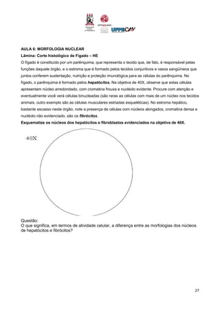 27
AULA 6: MORFOLOGIA NUCLEAR
Lâmina: Corte histológico de Fígado – HE
O fígado é constituído por um parênquima, que representa o tecido que, de fato, é responsável pelas
funções daquele órgão, e o estroma que é formado pelos tecidos conjuntivos e vasos sangüíneos que
juntos conferem sustentação, nutrição e proteção imunológica para as células do parênquima. No
fígado, o parênquima é formado pelos hepatócitos. Na objetiva de 40X, observe que estas células
apresentam núcleo arredondado, com cromatina frouxa e nucléolo evidente. Procure com atenção e
eventualmente você verá células binucleadas (são raras as células com mais de um núcleo nos tecidos
animais, outro exemplo são as células musculares estriadas esqueléticas). No estroma hepático,
bastante escasso neste órgão, note a presença de células com núcleos alongados, cromatina densa e
nucléolo não evidenciado, são os fibrócitos.
Esquematize os núcleos dos hepatócitos e fibroblastos evidenciados na objetiva de 40X.
Questão:
O que significa, em termos de atividade celular, a diferença entre as morfologias dos núcleos
de hepatócitos e fibrócitos?
 