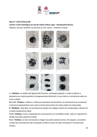 28
AULA 7: CICLO CELULAR
Lâmina: Corte histológico de raiz de cebola Allium cepa – Hematoxilina férrica
Objetivos da aula: identificar os períodos do ciclo celular – intérfase e mitose
A - Intérfase: as células são ligeiramente menores, morfologia poligonal; o núcleo é esférico e
apresenta seu material genético homogeneamente distribuído no seu interior e normalmente exibe um
único nucléolo.
B, C e D - Prófase: a célula e o núcleo já aumentaram de tamanhos; os cromossomos se condensam
e tornam-se gradualmente mais curtos e áreas claras dentro do núcleo podem ser observadas.
E - Metáfase: nesta fase, os cromossomos atingem seu estágio máximo de condensação e alinham-se
no plano equatorial da célula.
F e G - Anáfase: ocorre a separação dos cromossomos (ou cromátides-irmãs), cada um migrando em
direção aos pólos opostos da célula.
H e I - Telófase: os dois cromossomos chegam aos pólos opostos do fuso. Em seguida, o envoltório
nuclear será reconstituído (não visualizado ao MO) ao redor de cada cromossomo, formando dois
núcleos.
 