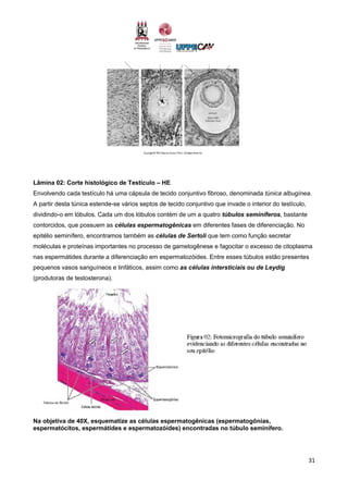 31
Lâmina 02: Corte histológico de Testículo – HE
Envolvendo cada testículo há uma cápsula de tecido conjuntivo fibroso, denominada túnica albugínea.
A partir desta túnica estende-se vários septos de tecido conjuntivo que invade o interior do testículo,
dividindo-o em lóbulos. Cada um dos lóbulos contém de um a quatro túbulos seminíferos, bastante
contorcidos, que possuem as células espermatogênicas em diferentes fases de diferenciação. No
epitélio seminífero, encontramos também as células de Sertoli que tem como função secretar
moléculas e proteínas importantes no processo de gametogênese e fagocitar o excesso de citoplasma
nas espermátides durante a diferenciação em espermatozóides. Entre esses túbulos estão presentes
pequenos vasos sanguíneos e linfáticos, assim como as células intersticiais ou de Leydig
(produtoras de testosterona).
Na objetiva de 40X, esquematize as células espermatogênicas (espermatogônias,
espermatócitos, espermátides e espermatozóides) encontradas no túbulo seminífero.
 