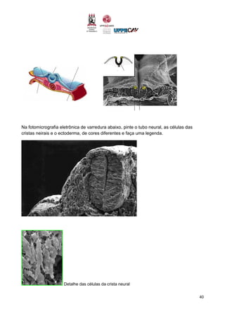 40
Na fotomicrografia eletrônica de varredura abaixo, pinte o tubo neural, as células das
cristas neirais e o ectoderma, de cores diferentes e faça uma legenda.
Detalhe das células da crista neural
 