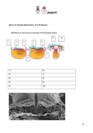 41
AULA 13: Período Embrionário: 4ª a 8ª Semana
Identifique as estruturas enumeradas nas ilustrações abaixo:
1) 6)
2) 7)
3) 8)
4) 9)
5) 10)
1 2 3 5 6
4
7
8 10
9
 