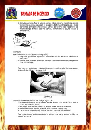 Página 80
5) Simultaneamente, fixar a cabeça com as mãos, elevar a mandíbula com os
indicadores e abrir a boca com os polegares. Esta manobra aplica-se a todas
as vítimas, principalmente naquelas vítimas de trauma, pois proporciona ao
mesmo tempo liberação das vias aéreas, alinhamento da coluna cervical e
imobilização.
(figura 01)
b) Manobra de Elevação do Queixo: (figura 02)
1) Segurar o queixo com o polegar e o indicador de uma das mãos e tracioná-lo
para cima.
2) Não se deve estender o pescoço da vítima, portanto mantenha a cabeça firme
com a outra mão.
Esta manobra aplica-se a todas as vítimas para obter liberação das vias aéreas,
porém não imobiliza a coluna cervical.
(figura 02)
c) Manobra de Hiperextensão da Cabeça: (figura 03)
1) Posicionar uma das mãos sobre a testa e a outra com os dedos tocando a
ponta do queixo da vítima.
2) Mantendo apoio com a mão sobre a testa, elevar o queixo da vítima.
3) Simultaneamente, efetuar uma leve hiperextensão do pescoço.
4) Fazer todo o movimento de modo a manter a boca da vítima aberta.
Este procedimento aplica-se apenas às vítimas que não possuam indícios de
trauma de coluna.
 