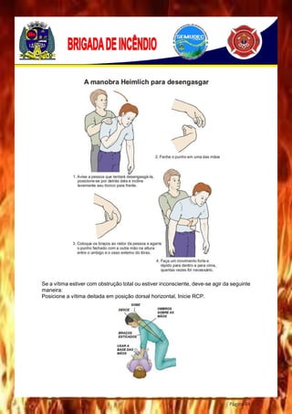 Página 84
Se a vítima estiver com obstrução total ou estiver inconsciente, deve-se agir da seguinte
maneira:
Posicione a vítima deitada em posição dorsal horizontal, Inicie RCP.
 