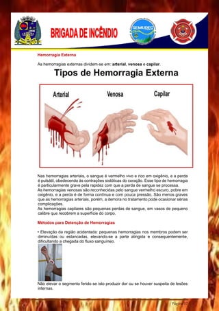 Página 97
Hemorragia Externa
As hemorragias externas dividem-se em: arterial, venosa e capilar.
Nas hemorragias arteriais, o sangue é vermelho vivo e rico em oxigênio, e a perda
é pulsátil, obedecendo às contrações sistólicas do coração. Esse tipo de hemorragia
é particularmente grave pela rapidez com que a perda de sangue se processa.
As hemorragias venosas são reconhecidas pelo sangue vermelho escuro, pobre em
oxigênio, e a perda é de forma contínua e com pouca pressão. São menos graves
que as hemorragias arteriais, porém, a demora no tratamento pode ocasionar sérias
complicações.
As hemorragias capilares são pequenas perdas de sangue, em vasos de pequeno
calibre que recobrem a superfície do corpo.
Métodos para Detenção de Hemorragias
• Elevação da região acidentada: pequenas hemorragias nos membros podem ser
diminuídas ou estancadas, elevando-se a parte atingida e consequentemente,
dificultando a chegada do fluxo sanguíneo.
Não elevar o segmento ferido se isto produzir dor ou se houver suspeita de lesões
internas.
 