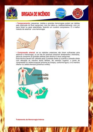 Página 98
• Tamponamento: pequenas, médias e grandes hemorragias podem ser detidas
pela obstrução do fluxo sanguíneo, com as mãos ou, preferencialmente, com um
pano limpo ou gaze esterilizada, fazendo um curativo compressivo. É o melhor
método de estancar uma hemorragia.
• Compressão arterial: se os métodos anteriores não forem suficientes para
estancar a hemorragia, ou se não for possível comprimir diretamente o ferimento,
deve-se comprimir as grandes artérias para diminuir o fluxo sanguíneo.
Essa técnica deverá ser utilizada após a pressão direta ou quando a pressão direta
com elevação do membro tenha falhado. No membro superior, o ponto de
compressão é a artéria braquial (próxima ao bíceps), conforme figura, e no membro
inferior é a artéria femoral (próxima à virilha)
Tratamento da Hemorragia Interna
 