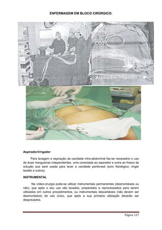 ENFERMAGEM EM BLOCO CIRÚRGICO.
Página 127
Aspirador/irrigador
Para lavagem e aspiração da cavidade intra-abdominal faz-se necessário o uso
de duas mangueiras independentes, uma conectada ao aspirador e outra ao frasco da
solução que será usada para lavar a cavidade peritoneal (soro fisiológico; ringer
lactato e outros).
INSTRUMENTAL
Na vídeo-cirurgia pode-se utilizar instrumentais permanentes (desmontáveis ou
não), que após o seu uso são lavados, preparados e reprocessados para serem
utilizados em outros procedimentos, ou instrumentais descartáveis (não devem ser
desmontados) de uso único, que após a sua primeira utilização deverão ser
desprezados.
 
