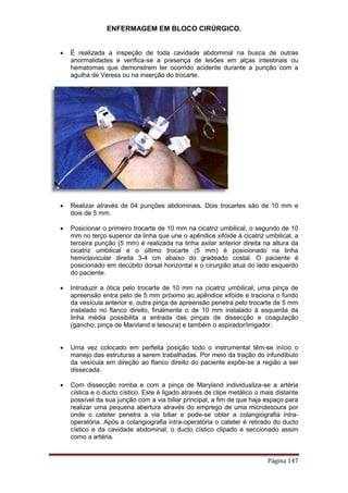 ENFERMAGEM EM BLOCO CIRÚRGICO.
Página 147
 É realizada a inspeção de toda cavidade abdominal na busca de outras
anormalidades e verifica-se a presença de lesões em alças intestinais ou
hematomas que demonstrem ter ocorrido acidente durante a punção com a
agulha de Veress ou na inserção do trocarte.
 Realizar através de 04 punções abdominais. Dois trocartes são de 10 mm e
dois de 5 mm.
 Posicionar o primeiro trocarte de 10 mm na cicatriz umbilical, o segundo de 10
mm no terço superior da linha que une o apêndice xifóide à cicatriz umbilical, a
terceira punção (5 mm) é realizada na linha axilar anterior direita na altura da
cicatriz umbilical e o último trocarte (5 mm) é posicionado na linha
hemiclavicular direita 3-4 cm abaixo do gradeado costal. O paciente é
posicionado em decúbito dorsal horizontal e o cirurgião atua do lado esquerdo
do paciente.
 Introduzir a ótica pelo trocarte de 10 mm na cicatriz umbilical, uma pinça de
apreensão entra pelo de 5 mm próximo ao apêndice xifóide e traciona o fundo
da vesícula anterior e, outra pinça de apreensão penetra pelo trocarte de 5 mm
instalado no flanco direito, finalmente o de 10 mm instalado à esquerda da
linha média possibilita a entrada das pinças de dissecção e coagulação
(gancho, pinça de Marvland e tesoura) e também o aspirador/irrigador.
 Uma vez colocado em perfeita posição todo o instrumental têm-se início o
manejo das estruturas a serem trabalhadas. Por meio da tração do infundíbulo
da vesícula em direção ao flanco direito do paciente expõe-se a região a ser
dissecada.
 Com dissecção romba e com a pinça de Maryland individualiza-se a artéria
cística e o ducto cístico. Este é ligado através de clipe metálico o mais distante
possível da sua junção com a via biliar principal, a fim de que haja espaço para
realizar uma pequena abertura através do emprego de uma microtesoura por
onde o cateter penetra a via biliar e pode-se obter a colangiografia intra-
operatória. Após a colangiografia intra-operatória o cateter é retirado do ducto
cístico e da cavidade abdominal, o ducto cístico clipado e seccionado assim
como a artéria.
 
