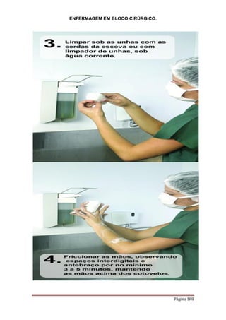 ENFERMAGEM EM BLOCO CIRÚRGICO.
Página 188
 