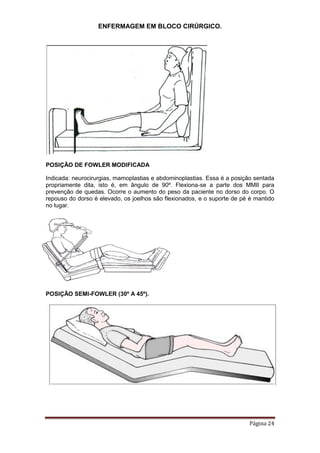 ENFERMAGEM EM BLOCO CIRÚRGICO.
Página 24
POSIÇÃO DE FOWLER MODIFICADA
Indicada: neurocirurgias, mamoplastias e abdominoplastias. Essa é a posição sentada
propriamente dita, isto é, em ângulo de 90º. Flexiona-se a parte dos MMII para
prevenção de quedas. Ocorre o aumento do peso da paciente no dorso do corpo. O
repouso do dorso é elevado, os joelhos são flexionados, e o suporte de pé é mantido
no lugar.
POSIÇÃO SEMI-FOWLER (30º A 45º).
 