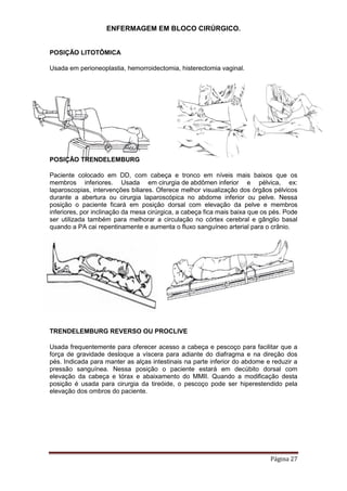 ENFERMAGEM EM BLOCO CIRÚRGICO.
Página 27
POSIÇÃO LITOTÔMICA
Usada em perioneoplastia, hemorroidectomia, histerectomia vaginal.
POSIÇÃO TRENDELEMBURG
Paciente colocado em DD, com cabeça e tronco em níveis mais baixos que os
membros inferiores. Usada em cirurgia de abdômen inferior e pélvica, ex:
laparoscopias, intervenções biliares. Oferece melhor visualização dos órgãos pélvicos
durante a abertura ou cirurgia laparoscópica no abdome inferior ou pelve. Nessa
posição o paciente ficará em posição dorsal com elevação da pelve e membros
inferiores, por inclinação da mesa cirúrgica, a cabeça fica mais baixa que os pés. Pode
ser utilizada também para melhorar a circulação no córtex cerebral e gânglio basal
quando a PA cai repentinamente e aumenta o fluxo sanguíneo arterial para o crânio.
TRENDELEMBURG REVERSO OU PROCLIVE
Usada frequentemente para oferecer acesso a cabeça e pescoço para facilitar que a
força de gravidade desloque a víscera para adiante do diafragma e na direção dos
pés. Indicada para manter as alças intestinais na parte inferior do abdome e reduzir a
pressão sanguínea. Nessa posição o paciente estará em decúbito dorsal com
elevação da cabeça e tórax e abaixamento do MMII. Quando a modificação desta
posição é usada para cirurgia da tireóide, o pescoço pode ser hiperestendido pela
elevação dos ombros do paciente.
 