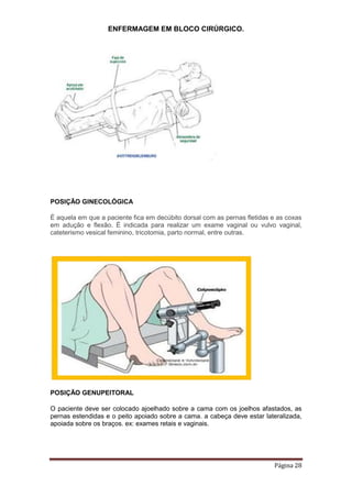 ENFERMAGEM EM BLOCO CIRÚRGICO.
Página 28
POSIÇÃO GINECOLÓGICA
É aquela em que a paciente fica em decúbito dorsal com as pernas fletidas e as coxas
em adução e flexão. É indicada para realizar um exame vaginal ou vulvo vaginal,
cateterismo vesical feminino, tricotomia, parto normal, entre outras.
POSIÇÃO GENUPEITORAL
O paciente deve ser colocado ajoelhado sobre a cama com os joelhos afastados, as
pernas estendidas e o peito apoiado sobre a cama. a cabeça deve estar lateralizada,
apoiada sobre os braços. ex: exames retais e vaginais.
 