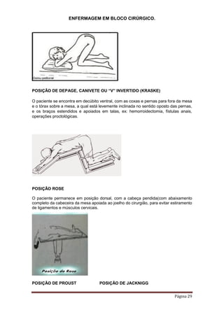 ENFERMAGEM EM BLOCO CIRÚRGICO.
Página 29
POSIÇÃO DE DEPAGE, CANIVETE OU “V” INVERTIDO (KRASKE)
O paciente se encontra em decúbito ventral, com as coxas e pernas para fora da mesa
e o tórax sobre a mesa, a qual está levemente inclinada no sentido oposto das pernas,
e os braços estendidos e apoiados em talas, ex: hemorroidectomia, fístulas anais,
operações proctológicas.
POSIÇÃO ROSE
O paciente permanece em posição dorsal, com a cabeça pendida(com abaixamento
completo da cabeceira da mesa apoiada ao joelho do cirurgião, para evitar estiramento
de ligamentos e músculos cervicais.
POSIÇÃO DE PROUST POSIÇÃO DE JACKNIGG
 