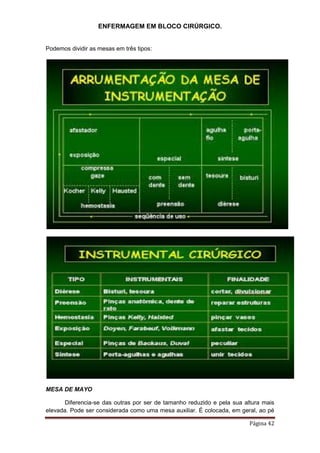 ENFERMAGEM EM BLOCO CIRÚRGICO.
Página 42
Podemos dividir as mesas em três tipos:
MESA DE MAYO
Diferencia-se das outras por ser de tamanho reduzido e pela sua altura mais
elevada. Pode ser considerada como uma mesa auxiliar. É colocada, em geral, ao pé
 