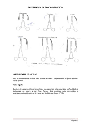 ENFERMAGEM EM BLOCO CIRÚRGICO.
Página 52
INSTRUMENTAL DE SÍNTESE
São os instrumentos usados para realizar suturas. Compreendem os porta-agulhas,
fios e agulhas.
Porta-agulha
Existem diversos modelos e tamanhos e sua escolha é feita segundo a profundidade e
delicadeza da sutura a ser feita. Temos dois modelos mais conhecidos e
invariavelmente utilizados: o de Hegar e o de Mathieu (figura 17.13).
 