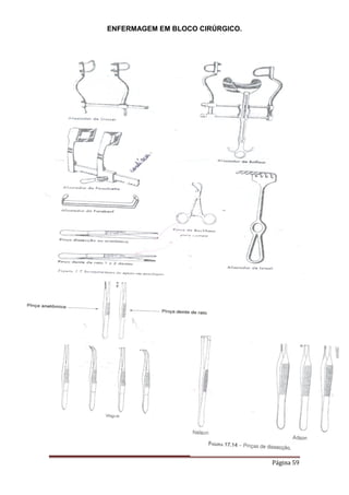 ENFERMAGEM EM BLOCO CIRÚRGICO.
Página 59
 