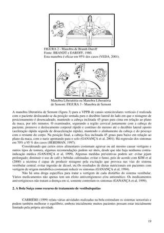 19
FIGURA 2 - Manobra de Brandt-Daroff
Fonte: BRANDT e DAROFF, 1980.
Esta manobra é eficaz em 95% dos casos (VEDA, 2001).
Manobra Liberatória ou Manobra Liberatória
de Semont: FIGURA 3 - Manobra de Semont
A manobra liberatória de Semont (figura 3) para a VPPB de canais semicirculares verticais é realizada
com o paciente deslocando-se da posição sentada para o decúbito lateral do lado em que o nistagmo de
posicionamento é desencadeado, mantendo a cabeça inclinada 45 graus para cima em relação ao plano
da maca, por três minutos. O examinador, segurando a região cervical juntamente com a cabeça do
paciente, promove o deslocamento corporal rápido e contínuo do mesmo até o decúbito lateral oposto
(aceleração rápida seguida de desaceleração rápida), mantendo o alinhamento da cabeça e do pescoço
com o restante do corpo. Na posição final, a cabeça fica inclinada 45 graus para baixo em relação ao
plano da maca, com o nariz apontando para o solo (GANANÇA et al, 2001). Há regressão dos sintomas
em 70% a 95 % dos casos (HERDMAN, 1997).
Considerando que certos erros alimentares costumam agravar ou até mesmo causar vertigens e
outros tipos de tontura, algumas recomendações podem ser úteis, desde que não haja nenhuma contra-
indicação médica (GANANÇA et al, 1999). Algumas medidas preventivas podem ser: evitar jejum
prolongado; diminuir o uso de café e bebidas cafeinadas; evitar o fumo, pois de acordo com KIM et al
(2000) a nicotina é capaz de produzir nistagmo pela excitação que provoca nas vias do sistema
vestibular central; evitar ingestão de álcool, etc.Os resultados de dietas nutricionais em pacientes com
vertigem de origem metabólica costumam reduzir os sintomas (GANANÇA et al, 1994).
Não há uma droga específica para tratar a vertigem de cada distúrbio do sistema vestibular.
Vários medicamentos não apenas tem um efeito antivertigionoso e/ou antiemético. Os medicamentos
antivertiginosos não tratam a doença em si, somente controlam os sintomas (GANANÇA et al, 1999).
2. A Bola Suíça como recurso de tratamento de vestibulopatias
CARRIÈRE (1999) relata várias atividades realizadas na bola estimulam os sistemas sensoriais e
podem também melhorar o equilíbrio, embora inicialmente muitos pacientes possam estar inicialmente
limitado pela própria atividade.
 