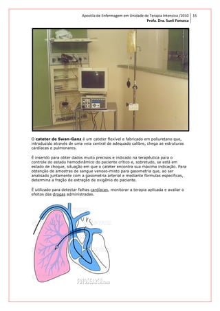 Apostila de Enfermagem em Unidade de Terapia Intensiva /2010
Profa. Dra. Sueli Fonseca
15
O cateter de Swan-Ganz é um cateter flexível e fabricado em poliuretano que,
introduzido através de uma veia central de adequado calibre, chega as estruturas
cardíacas e pulmonares.
É inserido para obter dados muito precisos e indicado na terapêutica para o
controle do estado hemodinâmico do paciente crítico e, sobretudo, se está em
estado de choque, situação em que o catéter encontra sua máxima indicação. Para
obtenção de amostras de sangue venoso-misto para gasometria que, ao ser
analisado juntamente com a gasometria arterial e mediante fórmulas específicas,
determina a fração de extração de oxigênio do paciente.
É utilizado para detectar falhas cardíacas, monitorar a terapia aplicada e avaliar o
efeitos das drogas administradas.
 