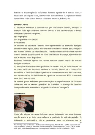 família e a psicoterapia são suficientes. Somente a partir dos 6 anos de idade, é
necessário, em alguns casos, intervir com medicamentos. A depressão infantil
desencadeia várias outras doenças tais como: anorexia, bulimia, etc.

Quadro Clínico
A Esclerose Tuberosa é caracterizada por Deficiência Mental, epilepsia e
erupção facial tipo adenoma sebáceo. Devido a tais características a doença
também foi chamada de epilóia.
epil = epilepsia
oi = oligofrenia ==> Epiloia
a = adenoma
Os sintomas da Esclerose Tuberosa são o aparecimento de neoplasias benignas
em um ou mais órgãos, sendo o sistema nervoso central e retina, pele, coração e
rins os mais comuns de serem afetados. Tumores cerebrais no Sistema Nervoso
Central também podem ocorrer em casos confirmados da doença, aparecendo até
aos 20 anos de idade do paciente.
Esclerose Tuberosa aparece no sistema nervoso central através de tumores
benignos e nódulos.
As variações de sintomas entre pacientes são muitas, mas, os mais comuns são
as crises epiléticas, incluindo também o Retardo Mental ou a hidrocefalia
secundária. A Deficiência Mental pode estar ausente em cerca de 30% dos casos,
mas as convulsões, de difícil controle, aparecem em cerca de 80%, começando
antes dos 5 anos de idade.
Os exames que se pode fazer para constatação e acompanhamentos da Esclerose
Tuberosos são os exames genéticos de Cariótipo, a Tomografia Craniana
Computadorizada, Ressonância Magnética Nuclear e Craniografia

Tratamento:




Ainda não há cura para essa síndrome, apenas tratamento para seus sintomas,
mas há muito a ser feito para melhorar a qualidade de vida do portador. O
tratamento é sintomático, isto é, procura-se sanar os sintomas que se
__________________________                                                               39
Prof. Wesley Lima de Oliveira – Bacharel em Enfermagem (UNIMONTES – 2000); Especialista em
Saúde da Família; Educação em Saúde; Gestão Clínica da Atenção Primária à Saúde (UNIMONTES
2003; 2005; 2009); Especializando em Enfermagem do Trabalho (UCAMPROMINAS – 2012)
 