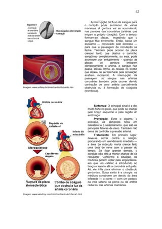 62


                                                                 A interrupção do fluxo de sangue para
                                                           o coração pode acontecer de várias
                                                           maneiras. A gordura vai se acumulando
                                                           nas paredes das coronárias (artérias que
                                                           irrigam o próprio coração). Com o tempo,
                                                           formam-se placas, impedindo que o
                                                           sangue flua livremente. Então, basta um
                                                           espasmo — provocado pelo estresse —
                                                           para que a passagem da circulação se
                                                           feche. Também pode ocorrer da placa
                                                           crescer tanto que obstrui o caminho
                                                           sangüíneo completamente, ou seja, pode
                                                           acontecer por entupimento - quando as
                                                           placas        de     gordura       entopem
                                                           completamente a artéria, o sangue não
                                                           passa. Dessa forma, as células no trecho
                                                           que deixou de ser banhado pela circulação
                                                           acabam morrendo. A interrupção da
                                                           passagem do sangue nas artérias
                                                           coronárias também pode ocorrer devido
                                                           contração de uma artéria parcialmente
Imagem: www.unifesp.br/dmed/cardio/ch/cardio.htm           obstruída ou à formação de coágulos
                                                           (trombose).




                                                                   Sintomas: O principal sinal é a dor
                                                             muito forte no peito, que pode se irradiar
                                                             pelo braço esquerdo e pela região do
                                                             estômago.
                                                                   Prevenção: Evite o cigarro, o
                                                             estresse, os alimentos ricos em
                                                             colesterol e o sedentarismo, que são os
                                                             principais fatores de risco. Também não
                                                             deixe de controlar a pressão arterial.
                                                                   Tratamento: Em primeiro lugar,
                                                             deve-se correr contra o relógio,
                                                             procurando um atendimento imediato —
                                                             a área do músculo morta cresce feito
                                                             uma bola de neve com o passar do
                                                             tempo. Se ficar grande demais, o
                                                             coração não terá a menor chance de se
                                                             recuperar. Conforme a situação, os
                                                             médicos podem optar pela angioplastia,
                                                             em que um catéter é introduzido no
                                                             braço e levado até a coronária entupida.
                                                             Ali, ele infla para eliminar o obstáculo
                                                             gorduroso. Outra saída é a cirurgia: os
                                                             médicos constroem um desvio da área
                                                             infartada — a ponte — com um pedaço
                                                             da veia safena da perna ou da artéria
                                                             radial ou das artérias mamárias.


Imagem: www.saludhoy.com/htm/homb/articulo/infarca1.html
 