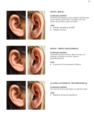 19
PONTO - RIM (E)
Localização anatômica
Na hemiconcha superior, na parte inferior da bifurcação
da raiz inferior da anti-hélice, escondido sob a raiz
inferior da anti-hélice, quase escondido
Ações
Funções energéticas do RIM
Funções viscerais
PONTO – TRIPLO AQUECEDOR (E)
Localização anatômica
Na metade da distancia entre o ápice do trago e do
antítrago, localizado na concha. Palpa-se
perpendicularmente.
Ações
A mesma do TA na acupuntura sistêmica
GLANDULAS INTERNAS / METABOLISMO (E)
Localização anatômica
No centro da incisura intertrágica, no chão da concha
Ações
Regulação das funções glandulares
 