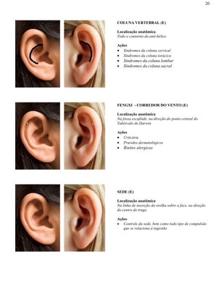 20
COLUNA VERTEBRAL (E)
Localização anatômica
Todo o contorno da anti-hélice
Ações
Síndromes da coluna cervical
Síndromes da coluna torácica
Síndromes da coluna lombar
Síndromes da coluna sacral
FENGXI - CORREDOR DO VENTO (E)
Localização anatômica
Na fossa escafóide, na direção do ponto central do
Tubérculo de Darwin
Ações
Urticária
Pruridos dermatológicos
Rinites alergicas
SEDE (E)
Localização anatômica
Na linha de inserção da orelha sobre a face, na direção
do centro do trago
Ações
Controle da sede, bem como todo tipo de compulsão
que se relaciona à ingestão
 