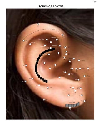 23
TODOS OS PONTOS
1 2
3
4
5
21
6
7
8
910
11
1213
14
15
16
16
16
27
28 1729
18
19
20
22
23
24
25
26
30
Shen Men
Boca
Fome
Simpatico
Rim
TA
GI
Feng Xi
Sede
Vício
Cic. Psqu.
Tornozelo
Quadril
 
