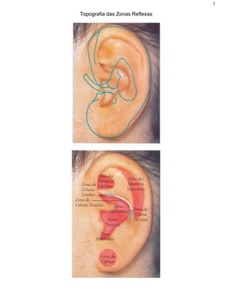 3
Topografia das Zonas Reflexas
 