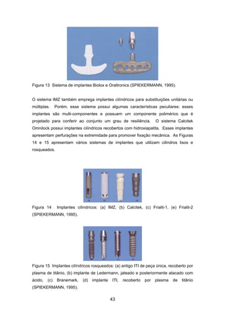 Figura 13 Sistema de implantes Biolox e Oraltronics (SPIEKERMANN, 1995).
O sistema IMZ também emprega implantes cilíndricos para substituições unitárias ou
múltiplas. Porém, esse sistema possui algumas características peculiares: esses
implantes são multi-componentes e possuem um componente polimérico que é
projetado para conferir ao conjunto um grau de resiliência. O sistema Calcitek
Omnilock possui implantes cilíndricos recobertos com hidroxiapatita. Esses implantes
apresentam perfurações na extremidade para promover fixação mecânica. As Figuras
14 e 15 apresentam vários sistemas de implantes que utilizam cilindros lisos e
rosqueados.
Figura 14 Implantes cilíndricos: (a) IMZ, (b) Calcitek, (c) Frialit-1, (e) Frialit-2
(SPIEKERMANN, 1995).
Figura 15 Implantes cilíndricos rosqueados: (a) antigo ITI de peça única, recoberto por
plasma de titânio, (b) implante de Ledermann, jateado e posteriormente atacado com
ácido, (c) Branemark, (d) implante ITI, recoberto por plasma de titânio
(SPIEKERMANN, 1995).
43
 