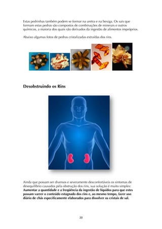 ! "+!
Estas pedrinhas também podem se formar na uretra e na bexiga. Os sais que
formam estas pedras são compostos de combinações de minerais e outros
químicos, a maioria dos quais são derivados da ingestão de alimentos impróprios.
Abaixo algumas fotos de pedras cristalizadas extraídas dos rins.
.
Desobstruindo os Rins
Ainda que possam ser diversos e severamente desconfortáveis os sintomas de
desequilíbrio causados pela obstrução dos rins, sua solução é muito simples:
Aumentar a quantidade e a freqüência da ingestão de líquidos para que estes
possam varrer o conteúdo estagnado dos rins e, ao mesmo tempo, fazer uso
diário de chás especificamente elaborados para dissolver os cristais de sal.
 